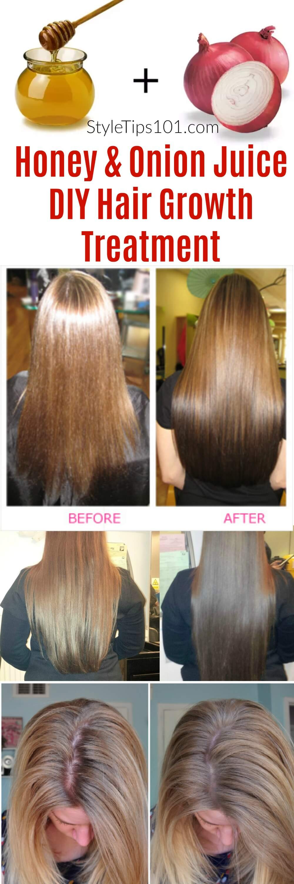 Best ideas about Hair Growth Treatment DIY
. Save or Pin ion Juice & Honey DIY Hair Growth Treatment Now.