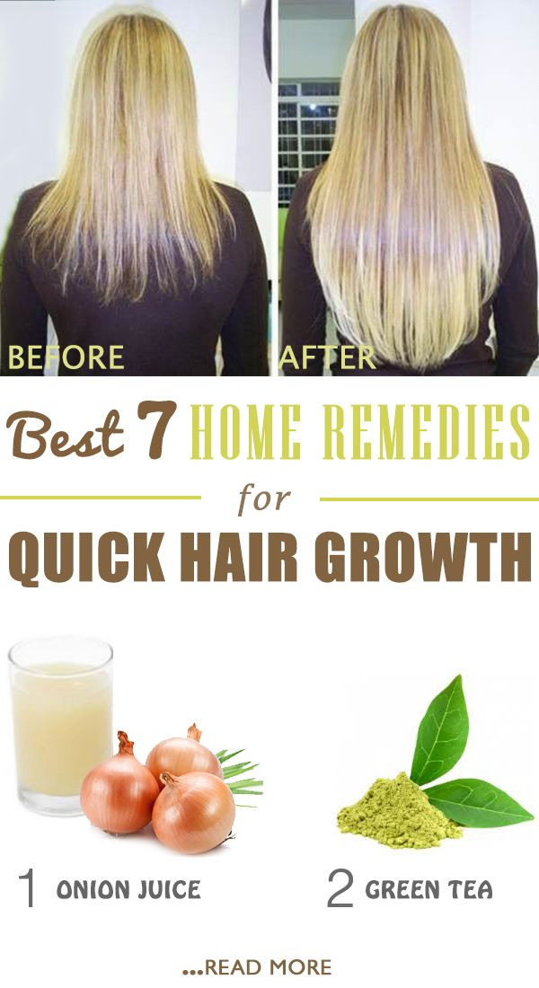 Best ideas about Hair Growth Treatment DIY
. Save or Pin 25 best ideas about Quick Hair Growth on Pinterest Now.