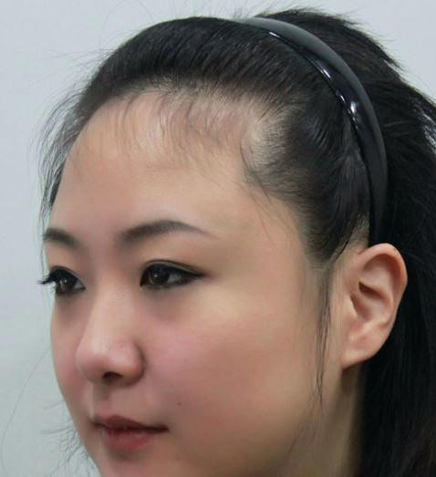 Hairstyles For Receding Hairline Female
 home improvement Hairstyles for receding hairline female