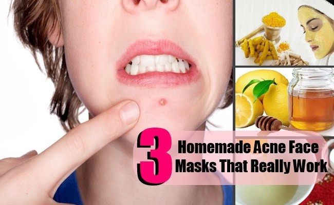 Best ideas about Best DIY Acne Mask
. Save or Pin 3 DIY Homemade Acne Face Masks That Really Work Now.