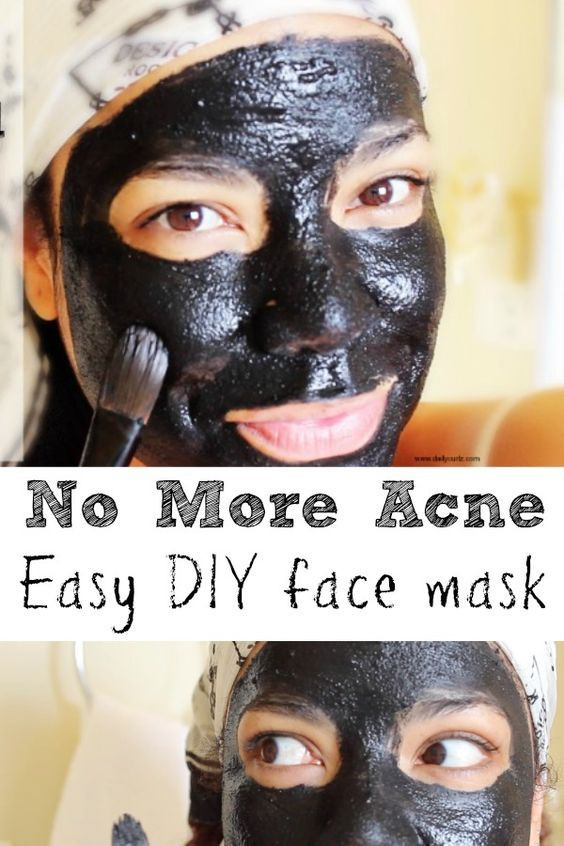Best ideas about Charcoal Mask For Acne DIY
. Save or Pin No more Acne and uneven skin with this amazing charcoal Now.