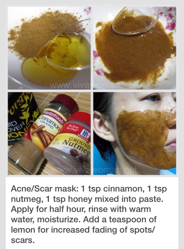 Best ideas about DIY Acne Scar Mask
. Save or Pin DIY Acne scar Mask Now.