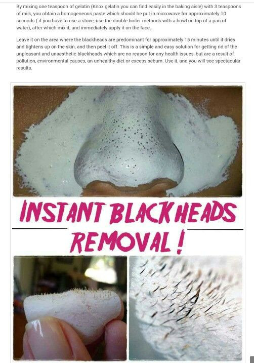 Best ideas about DIY Blackhead Removal
. Save or Pin 1000 ideas about Natural Blackhead Remover on Pinterest Now.