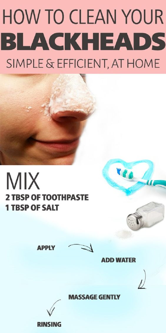 Best ideas about DIY Blackhead Removal
. Save or Pin 12 Beauty Hacks for this Week Pretty Designs Now.