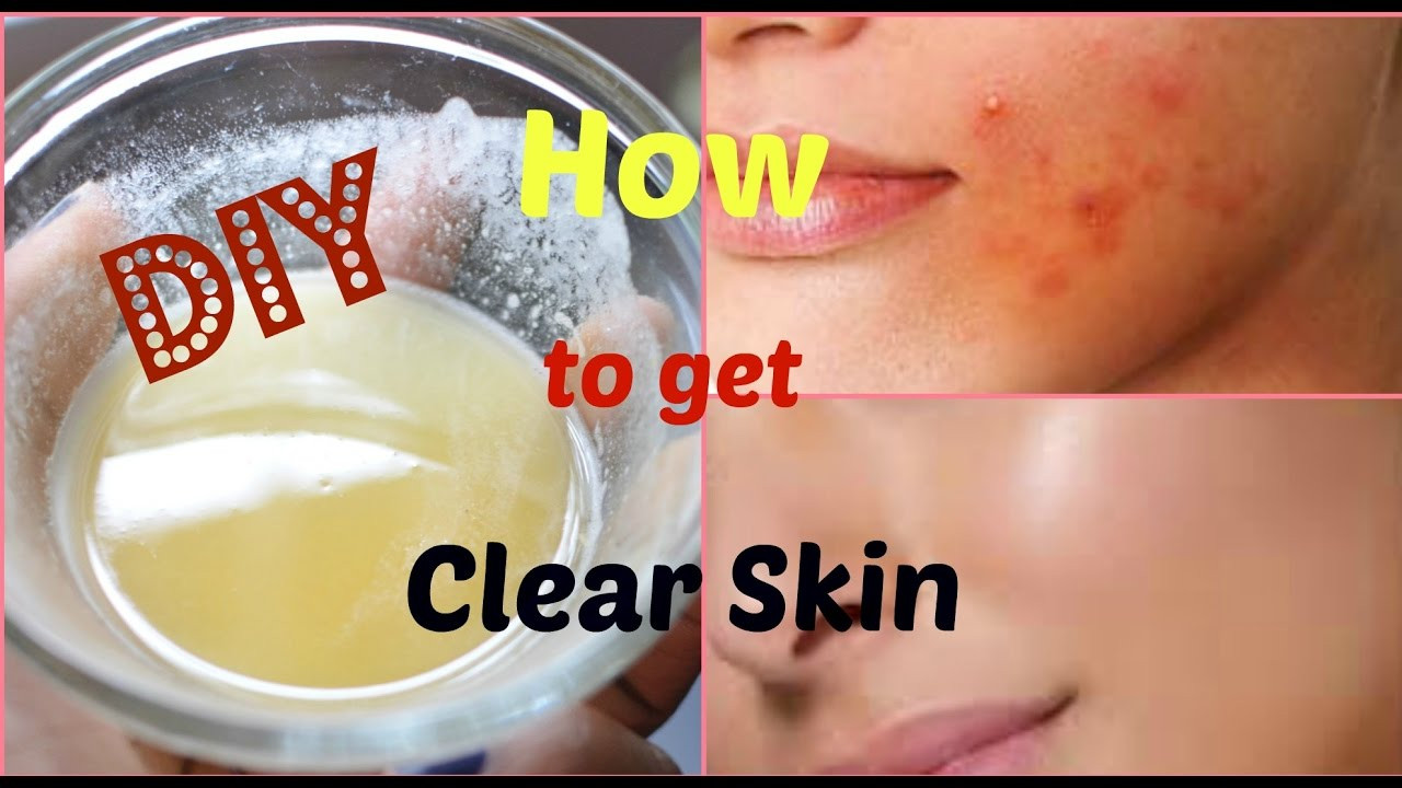 Best ideas about DIY Face Mask To Get Rid Of Acne
. Save or Pin DIY Face Mask to Get Rid of Acne & Acne Scars FAST Now.