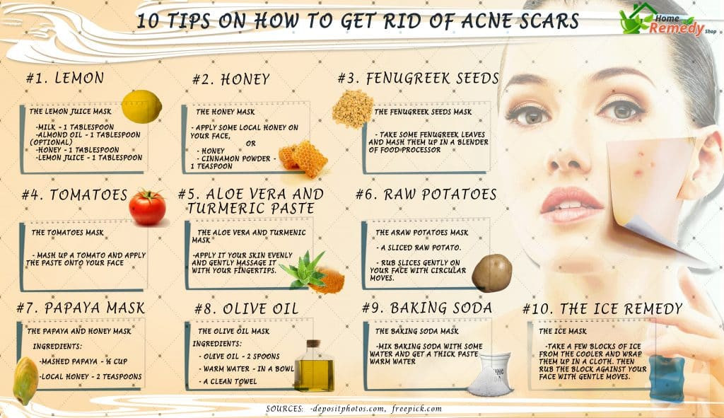 Best ideas about DIY Face Mask To Get Rid Of Acne
. Save or Pin 10 Tips on How to Rid of Acne Scars Home Reme s Now.