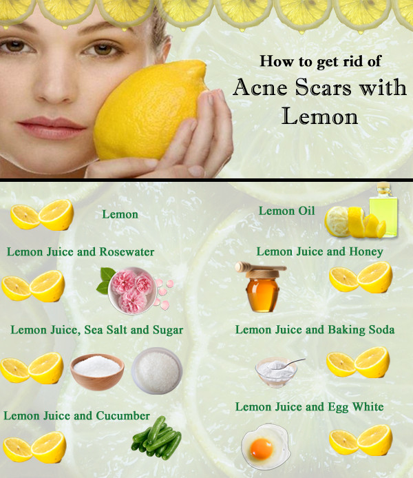 Best ideas about DIY Face Mask To Get Rid Of Acne
. Save or Pin Can I Use Lemon For Acne Scars Removal Now.