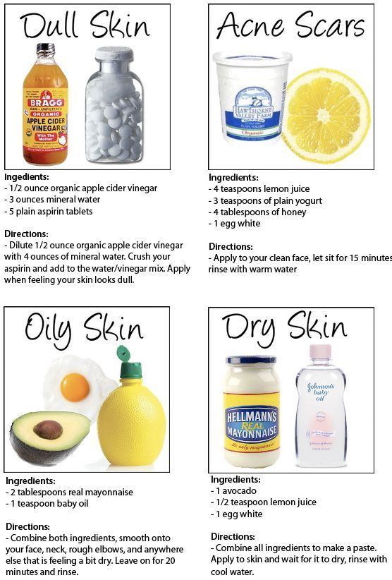 Best ideas about DIY Face Mask To Get Rid Of Acne
. Save or Pin How To Get Rid Pimples Acne Overnight Fast Now.