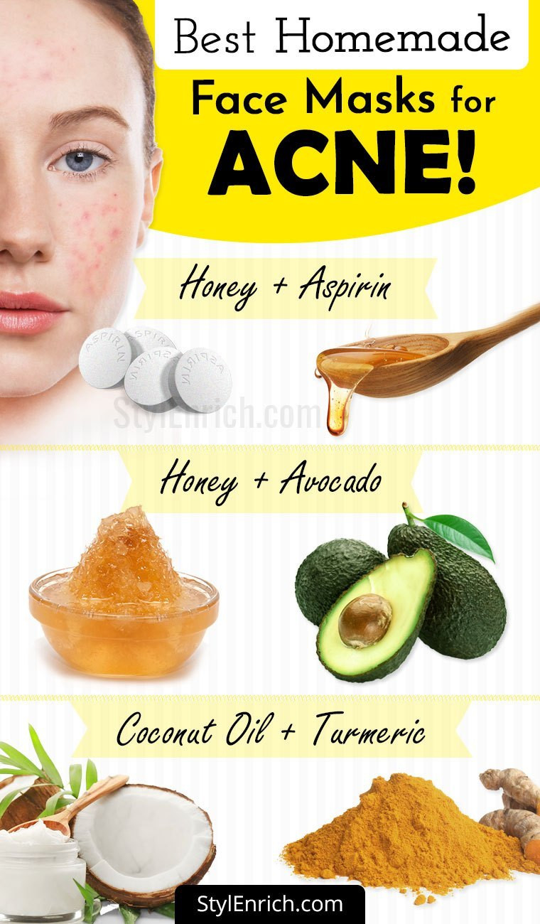 Best ideas about DIY Face Mask To Get Rid Of Acne
. Save or Pin Homemade Face Mask For Acne Treatment At Home Now.