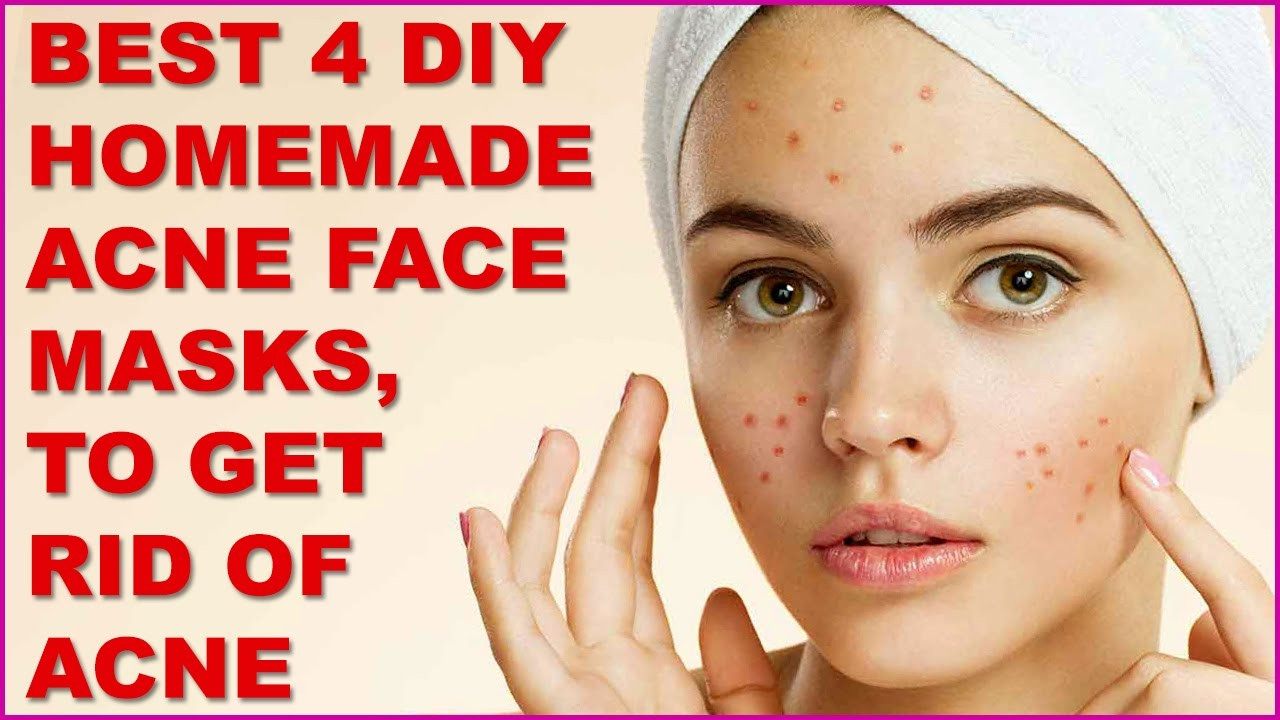 Best ideas about Acne DIY Face Masks
. Save or Pin Best 4 DIY Homemade Acne Face Masks To Get Rid Acne Now.