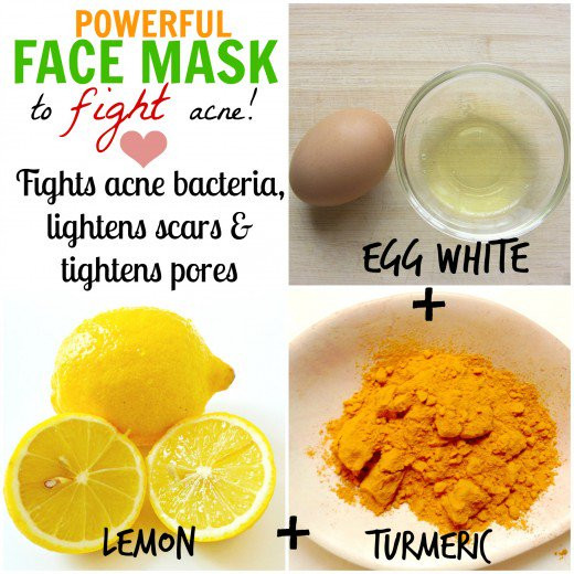 Best ideas about Acne DIY Face Masks
. Save or Pin DIY Natural Homemade Face Masks for Acne Cure Now.