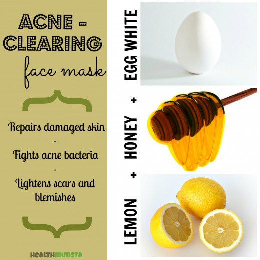 Best ideas about Acne DIY Face Masks
. Save or Pin DIY Top 5 Easy Homemade Face Mask Recipes for Beautiful Now.