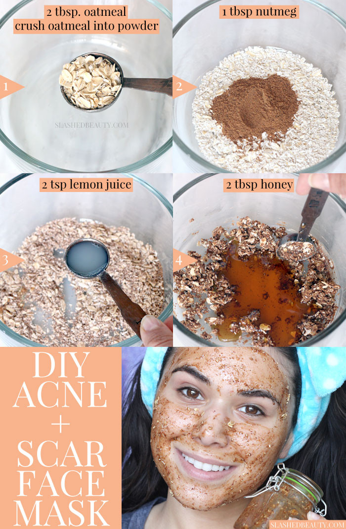 Best ideas about Acne DIY Mask
. Save or Pin Best DIY Face Mask for Acne & Scars Now.