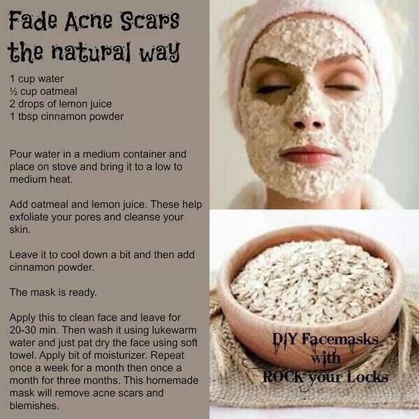 Best ideas about Acne Face Mask DIY
. Save or Pin DIY acne scar mask I ll give it a try Now.