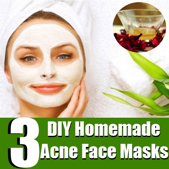 Best ideas about Acne Face Masks DIY
. Save or Pin Top 3 DIY Homemade Acne Face Masks Now.