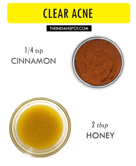 Best ideas about Acne Face Masks DIY
. Save or Pin 10 Amazing 2 ingre nts all natural homemade face masks Now.