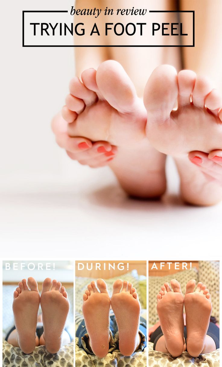 Best ideas about Baby Foot Peel DIY
. Save or Pin Best 25 Foot peel ideas on Pinterest Now.