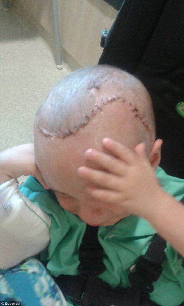 Best ideas about Baby Hit Back Of Head On Tile Floor
. Save or Pin Boy suffered horrific injuries after he fell from the Now.