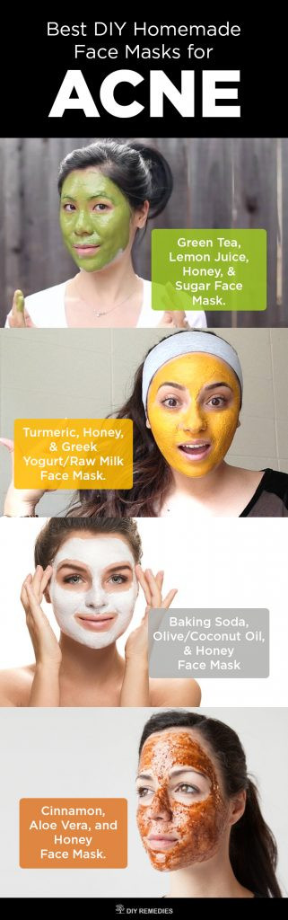 Best ideas about Best DIY Face Mask For Acne
. Save or Pin 6 Best DIY Homemade Face Masks for Acne Now.