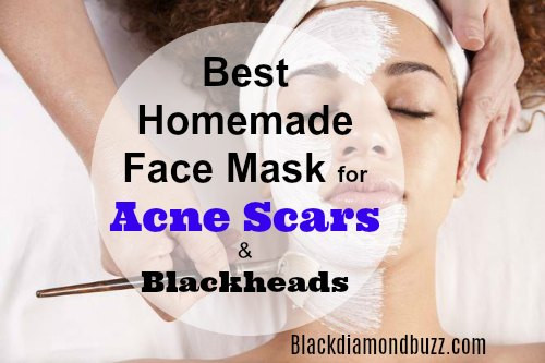 Best ideas about Best DIY Face Mask For Acne
. Save or Pin DIY Face Mask for Acne 7 Best Homemade Face Masks Now.