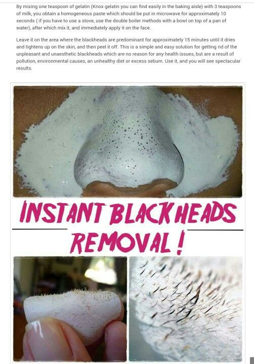 Best ideas about Blackhead Removal Mask DIY
. Save or Pin 1000 ideas about Natural Blackhead Remover on Pinterest Now.