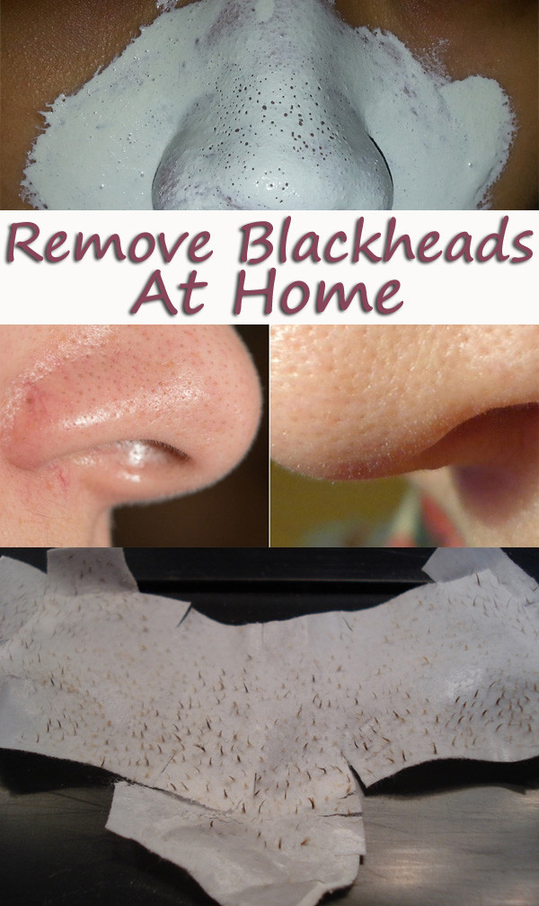 Best ideas about Blackhead Removal Mask DIY
. Save or Pin Homemade Blackheads Remover Tutorials and Ideas Hative Now.