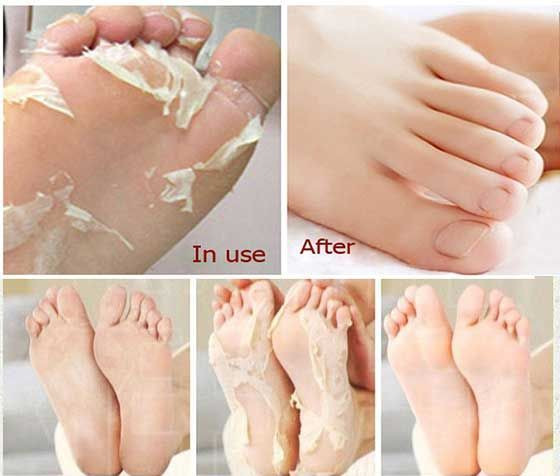 Best ideas about DIY Baby Foot Peel
. Save or Pin 17 Best ideas about Foot Peel on Pinterest Now.