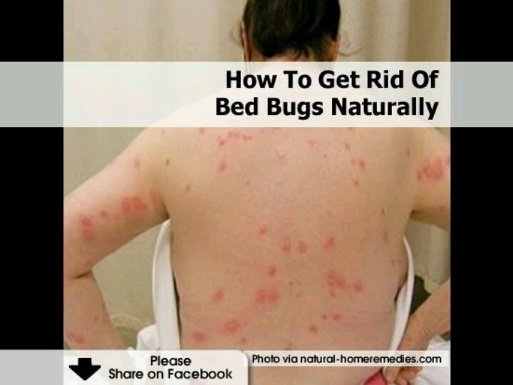 Best ideas about DIY Bed Bug Removal
. Save or Pin rid of bed bugs helpful hints Pinterest Now.