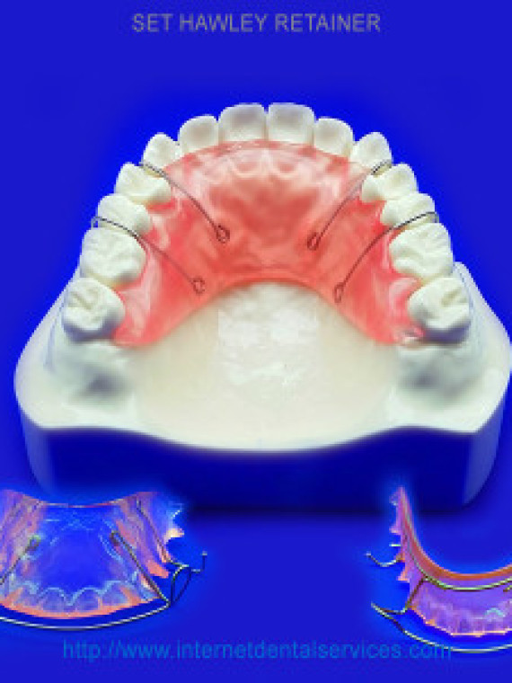 Best ideas about DIY Denture Kits
. Save or Pin Personal DIY dental impression kits for custom teeth devices Now.