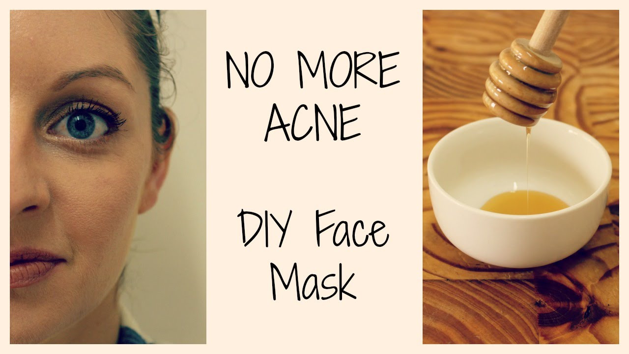 Best ideas about DIY Face Mask For Clear Skin
. Save or Pin HOW TO GET CLEAR ACNE FREE SKIN Now.