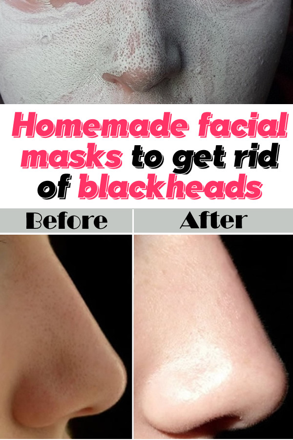 Best ideas about DIY Face Mask To Remove Blackheads
. Save or Pin Homemade facial masks to rid of blackheads Beauty is Now.