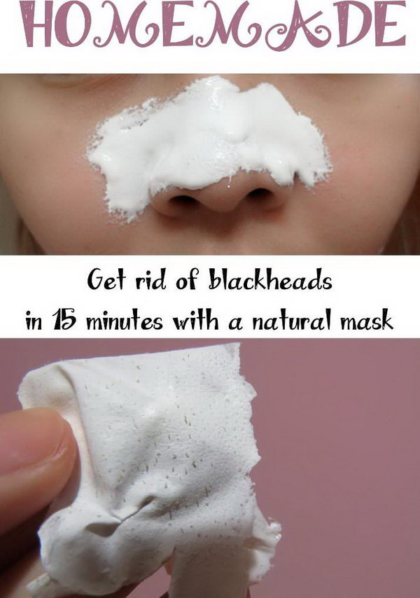 Best ideas about DIY Face Mask To Remove Blackheads
. Save or Pin Homemade Blackheads Remover Tutorials and Ideas Hative Now.