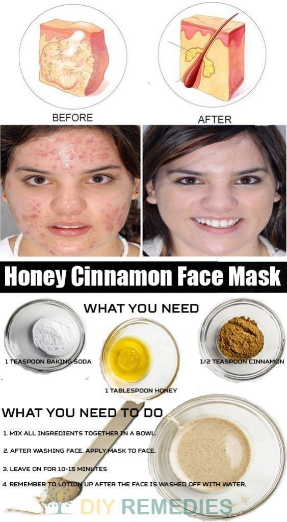 Best ideas about DIY Face Mask Without Honey
. Save or Pin 25 best ideas about Honey cinnamon mask on Pinterest Now.