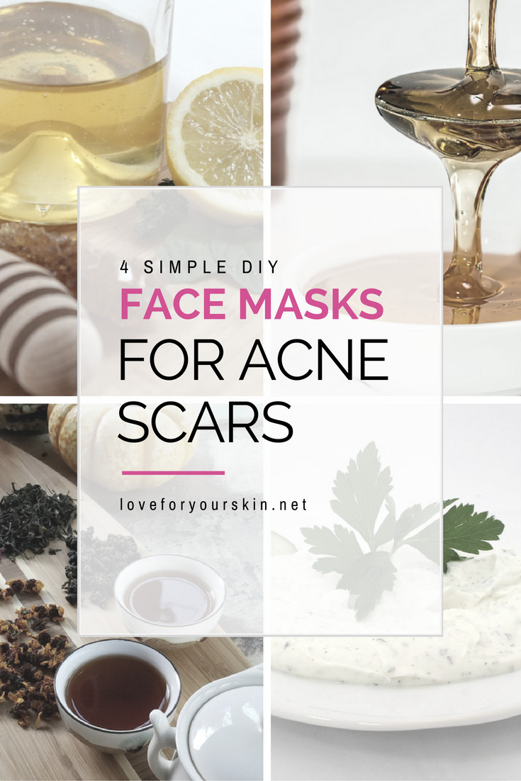 Best ideas about DIY Face Masks For Acne Scars
. Save or Pin 4 Simple DIY Face Masks for Acne Scars Loveforyourskin Now.