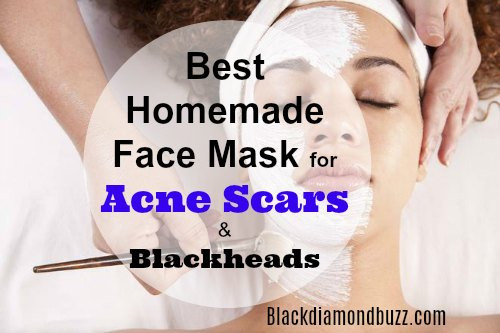 Best ideas about DIY Face Masks For Acne Scars
. Save or Pin DIY Face Mask for Acne 7 Best Homemade Face Masks Now.