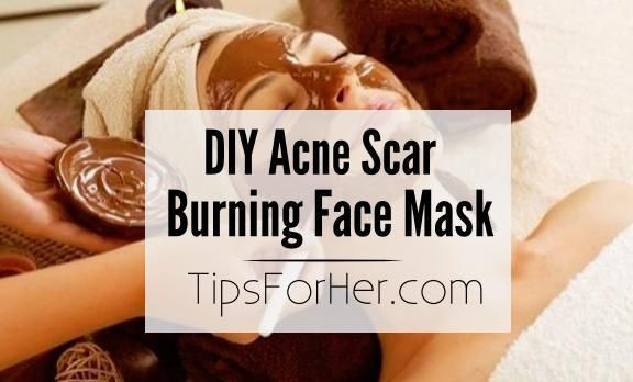 Best ideas about DIY Face Masks For Acne Scars
. Save or Pin 1116 best images about Acne Skin Challenges on Pinterest Now.