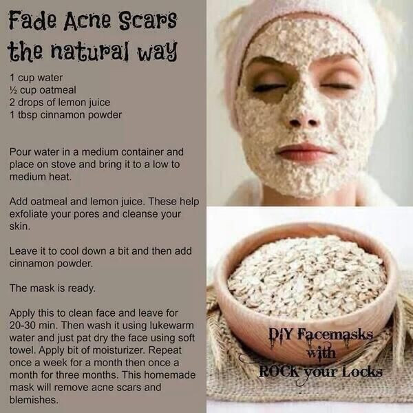 Best ideas about DIY Facial Mask For Acne Scars
. Save or Pin DIY acne scar mask I ll give it a try Now.