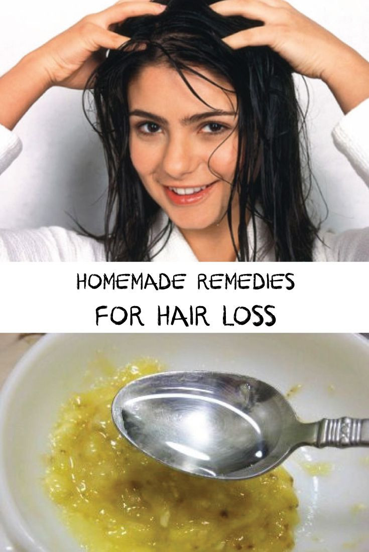 Best ideas about Hair Growth Remedies DIY
. Save or Pin 281 best images about hair loss treatments on Pinterest Now.