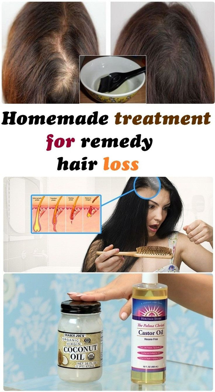Best ideas about Hair Growth Remedies DIY
. Save or Pin Homemade treatment for remedy hair loss hair Now.