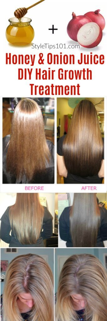 Best ideas about Hair Growth Remedies DIY
. Save or Pin ion Juice & Honey DIY Hair Growth Treatment Now.