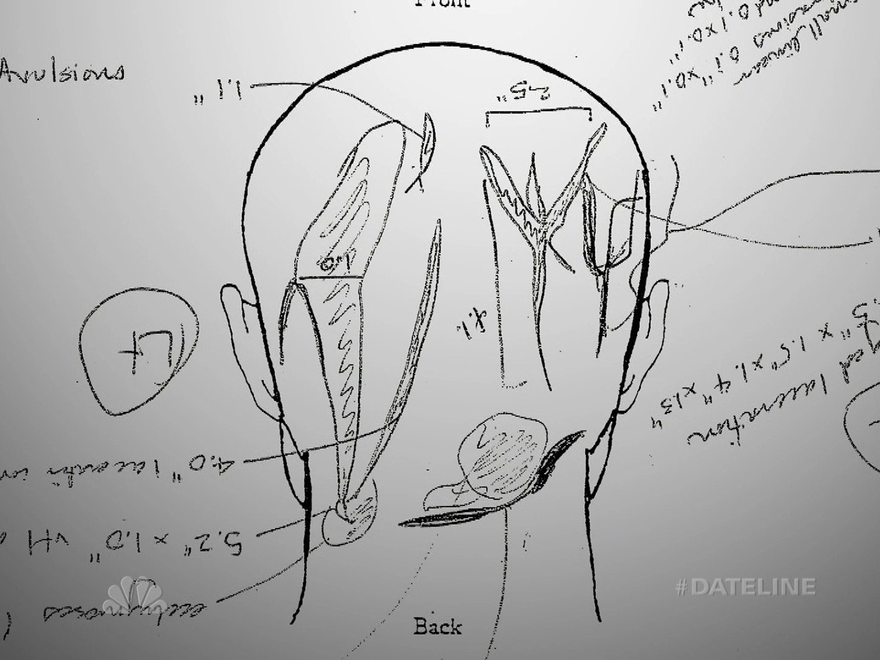 Best ideas about The Staircase Owl Theory
. Save or Pin Reversal of Fortune Part 3 NBC News Now.