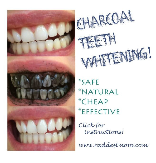 Best ideas about Activated Charcoal Teeth Whitening DIY
. Save or Pin Safe natural teeth whitening using Activated Charcoal Now.