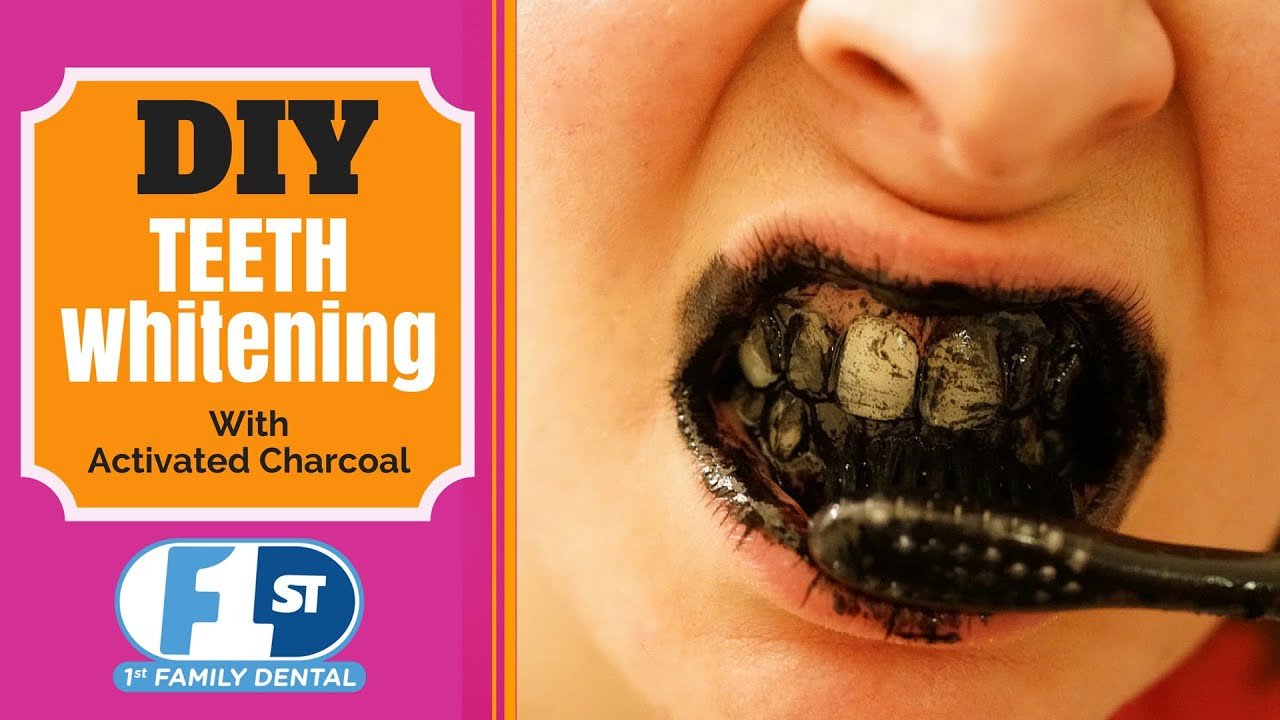 Best ideas about Activated Charcoal Teeth Whitening DIY
. Save or Pin Teeth Whitening with Activated Charcoal Dental DIY 1st Now.