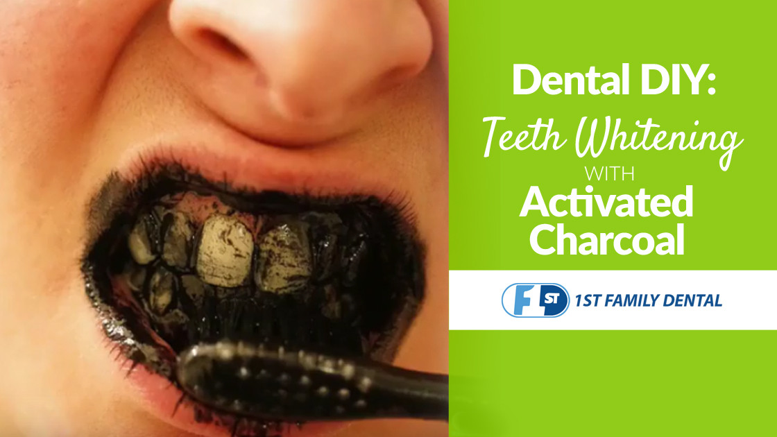 Best ideas about Activated Charcoal Teeth Whitening DIY
. Save or Pin DIY Teeth Whitening with Activated Charcoal Now.