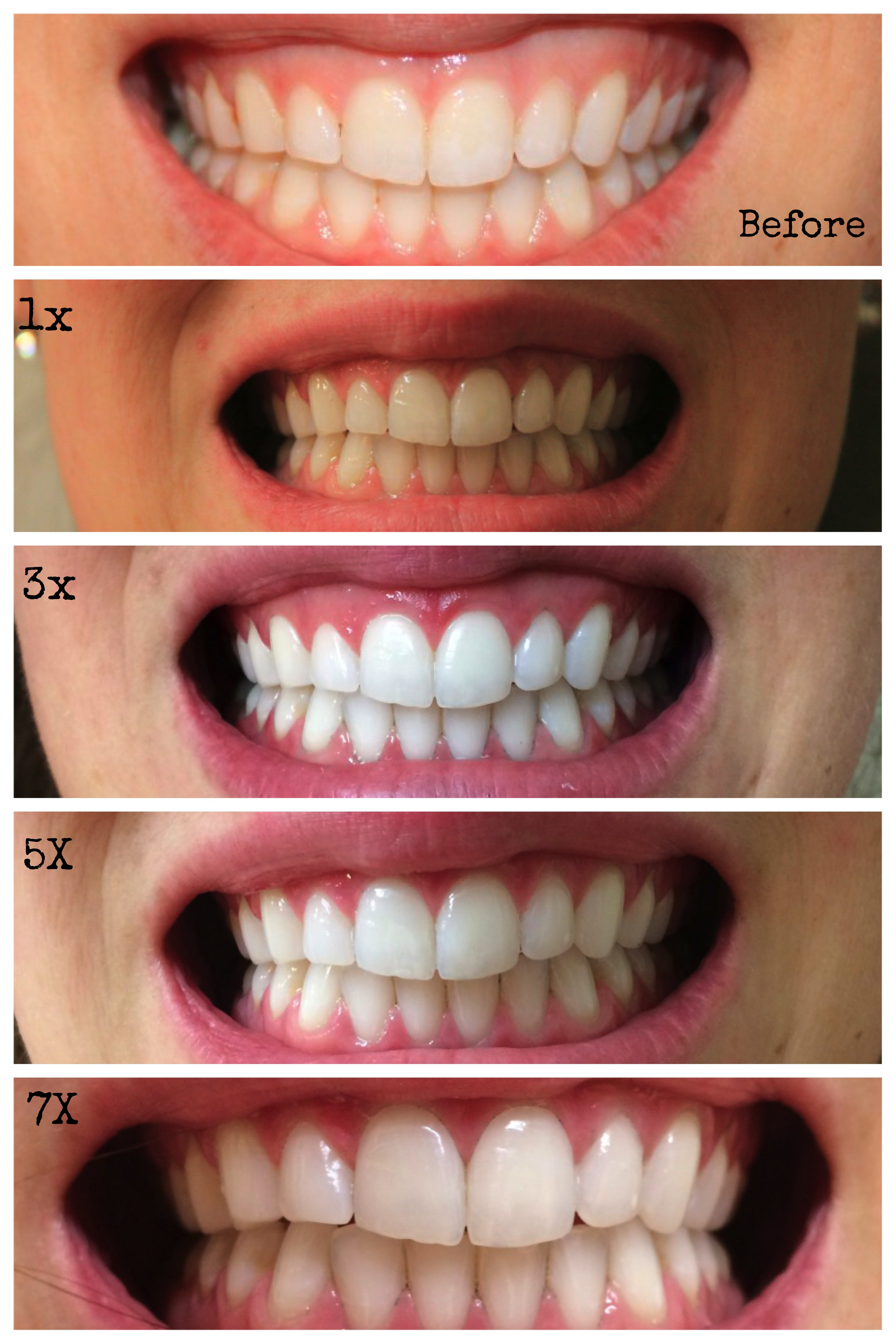 Best ideas about Activated Charcoal Teeth Whitening DIY
. Save or Pin DIY Teeth Whitening Now.