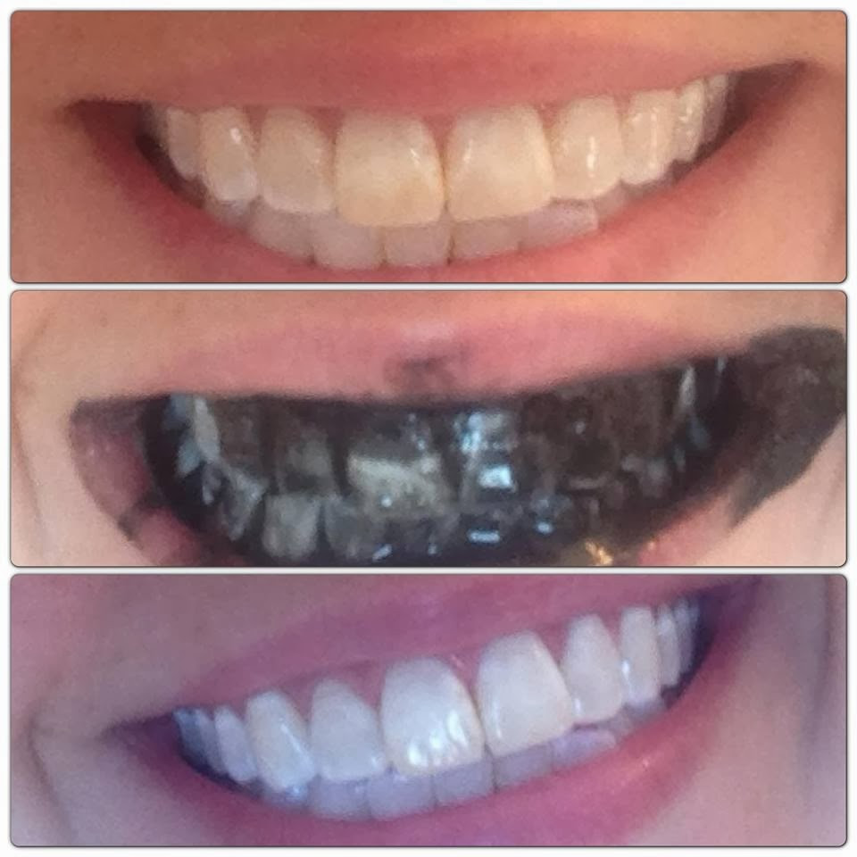 Best ideas about Activated Charcoal Teeth Whitening DIY
. Save or Pin Retreat at Cross Mountain Apartments San Antonio TX Now.