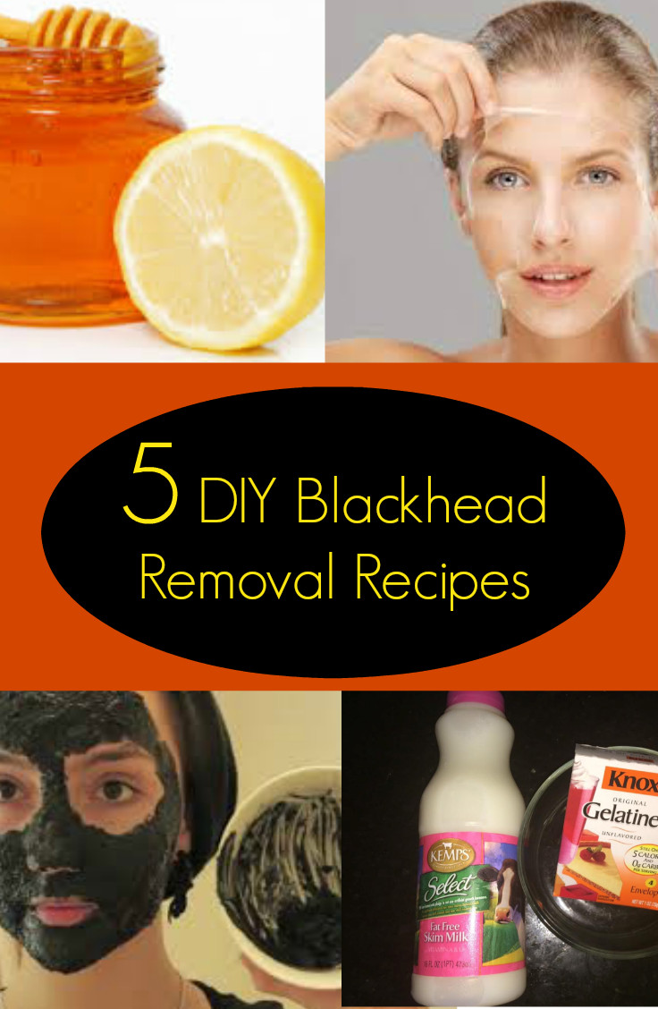 Best ideas about Blackhead Removal DIY
. Save or Pin 5 DIY Blackhead Removal Recipes Now.
