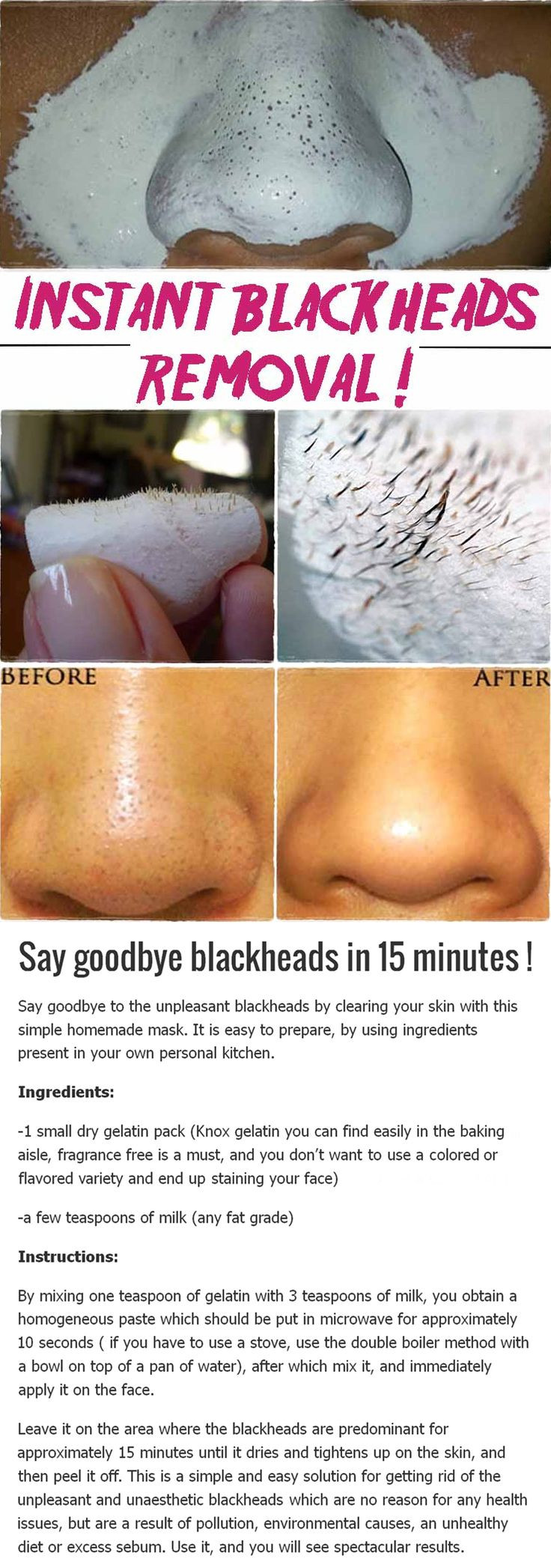 Best ideas about Blackhead Removal DIY
. Save or Pin 25 bästa Naturbehandling idéerna på Pinterest Now.