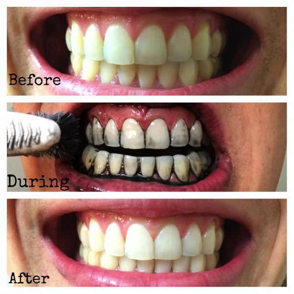 Best ideas about Charcoal Teeth Whitening DIY
. Save or Pin Retreat at Cross Mountain Apartments San Antonio TX Now.