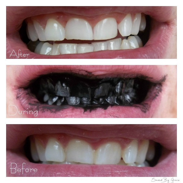 Best ideas about Charcoal Teeth Whitening DIY
. Save or Pin Brushing Teeth with Activated Charcoal Saved By Grace Now.
